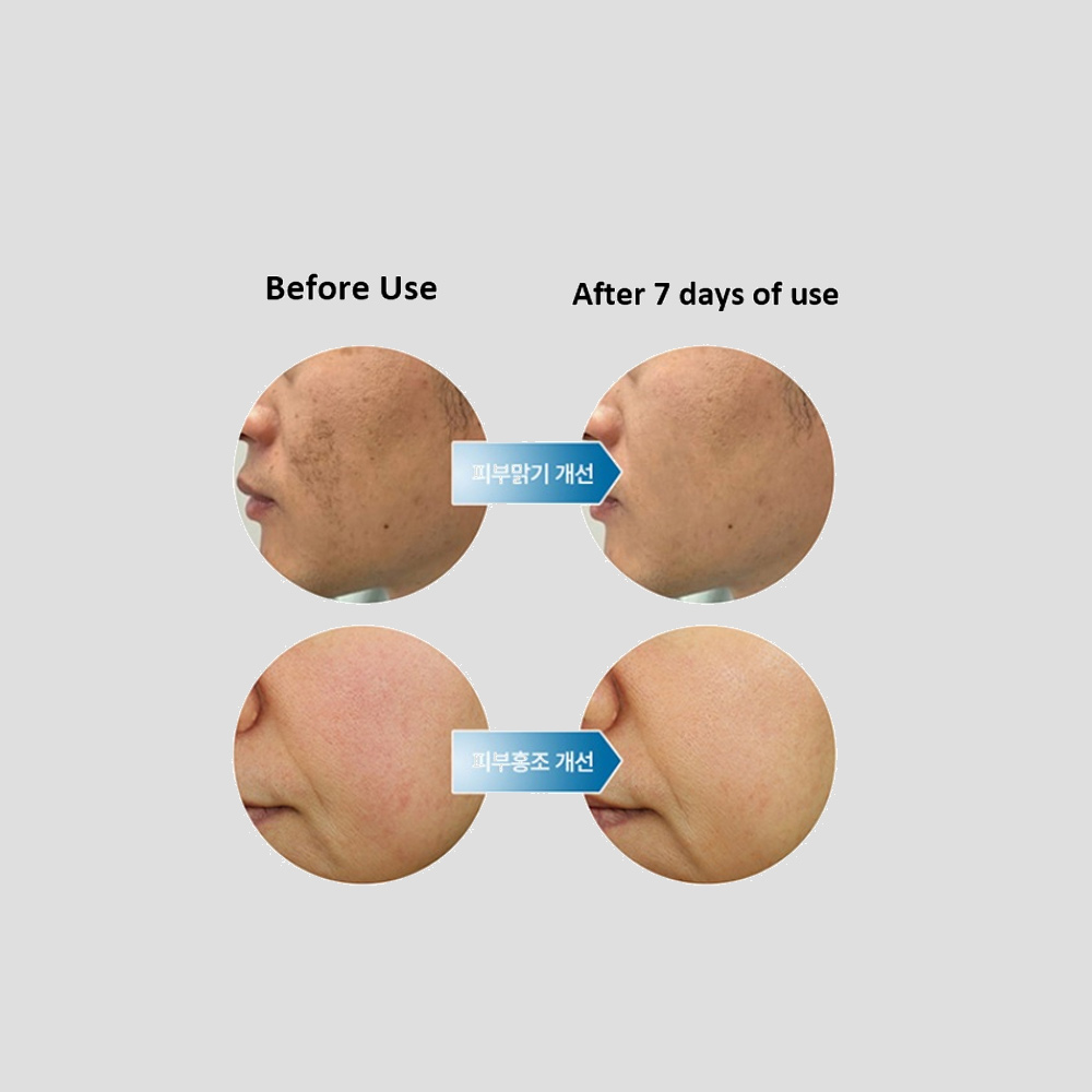 deepeffectaxisome_skinbooster_drstouch_img1