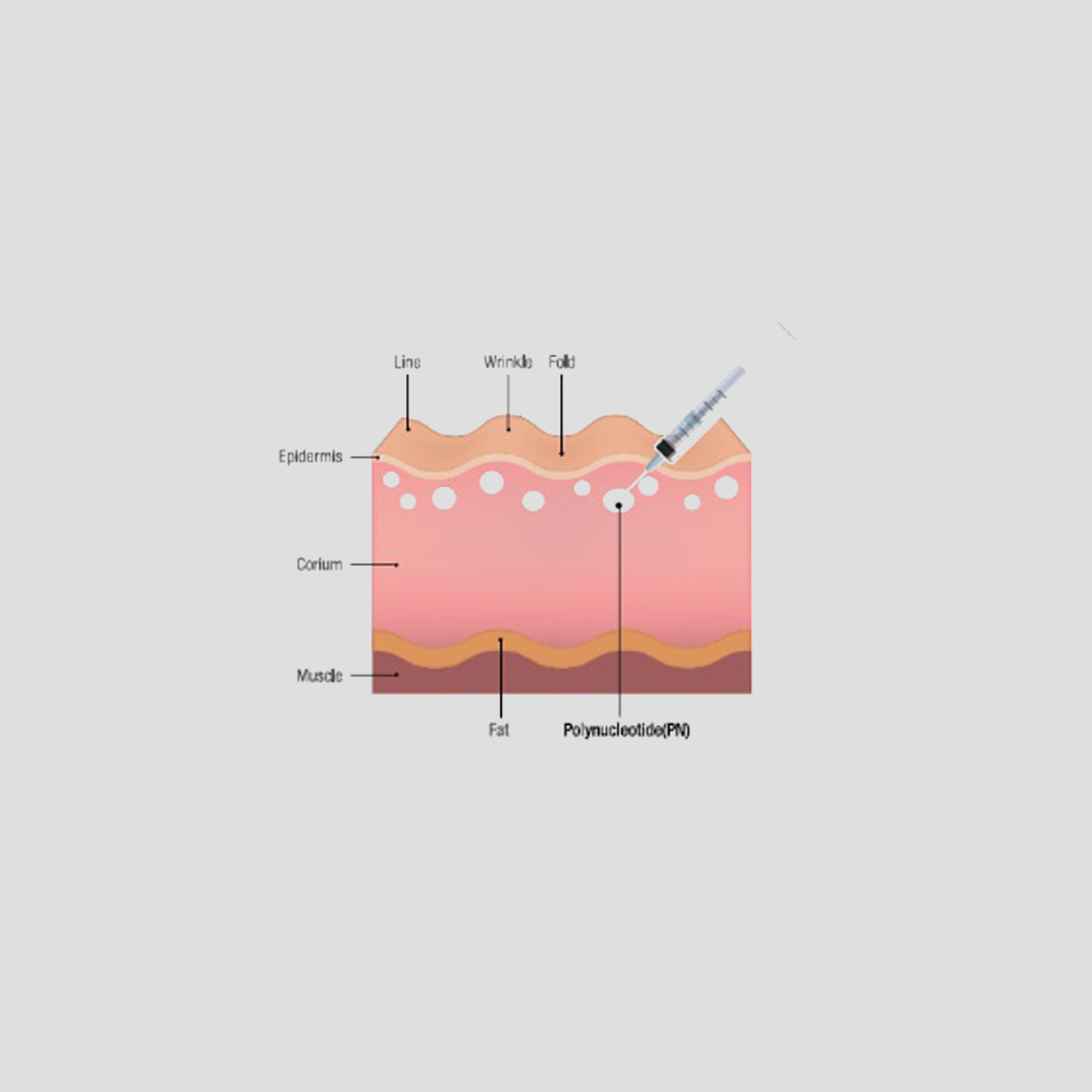 regevanpn_skinbooster_derma_img1