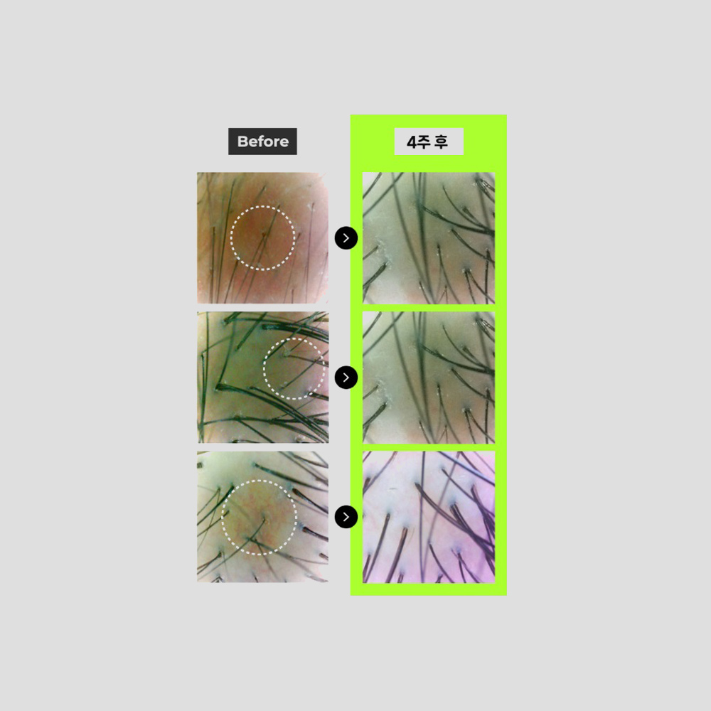 grabhair_skinbooster_suan_img1